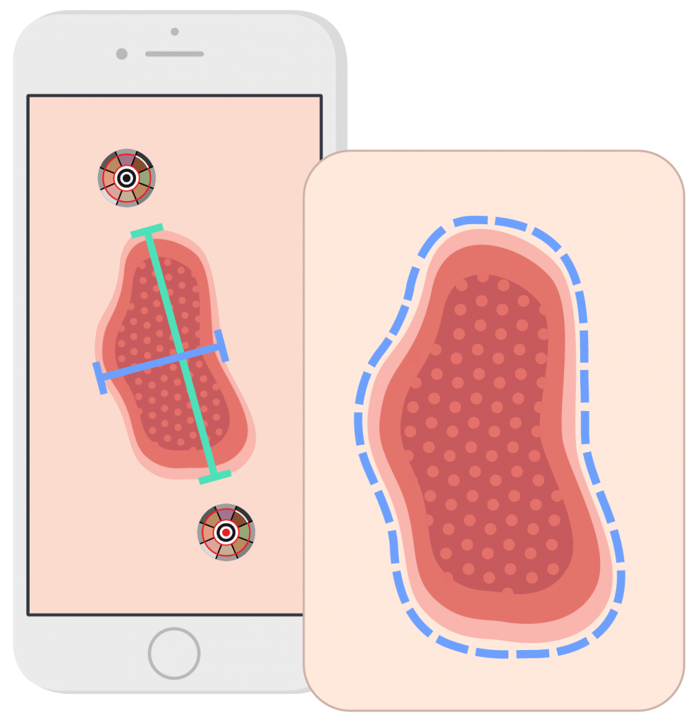 Digital Wound Management US Healthy